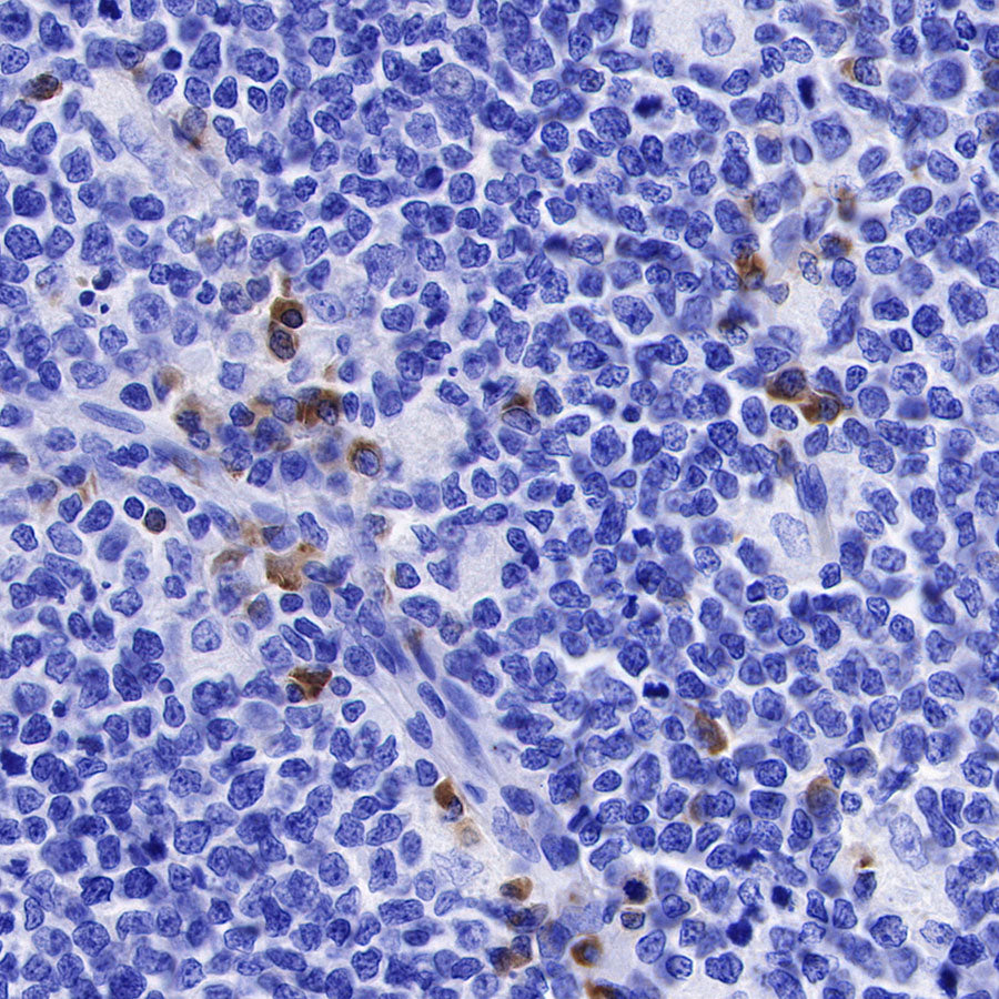 Human IgG F(c) Recombinant Rabbit mAb (SDT-318-37)