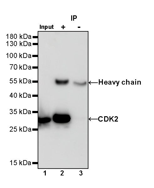 CDK2 Recombinant Rabbit mAb (S-1308-13)