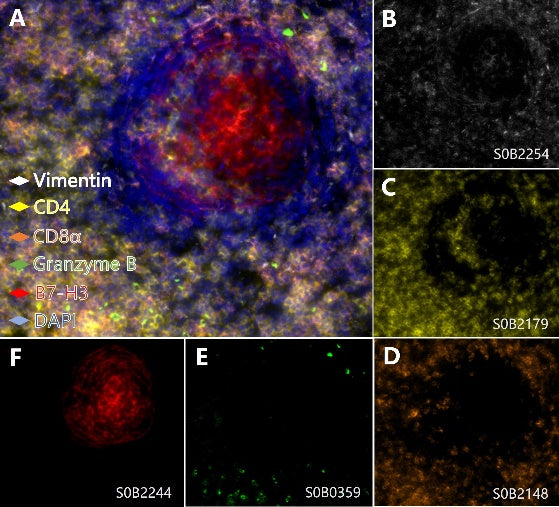B7-H3, Vimentin, CD8α, CD4, Granzyme B Antibody Panel