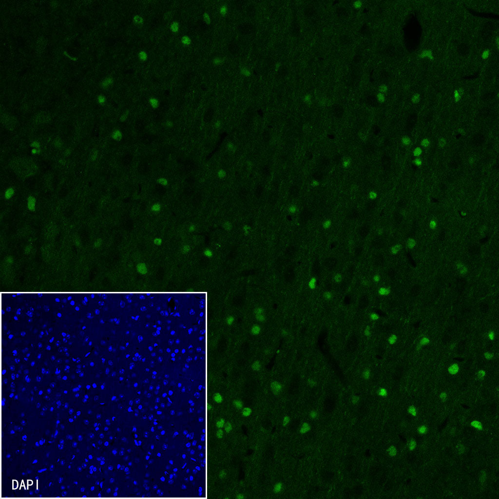 Olig2 Recombinant Rabbit mAb,PBS Only (SDT-648-155)