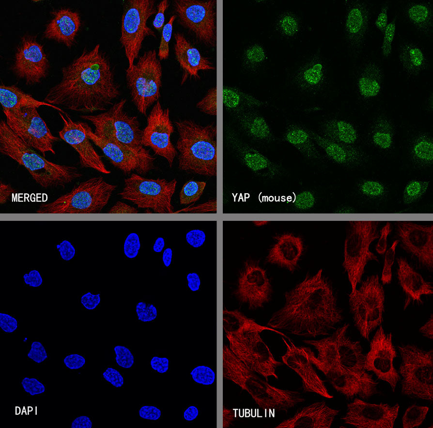 YAP Recombinant Rabbit mAb (S-3921-42)