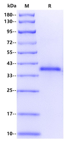 Human SETD2 Protein, His tag