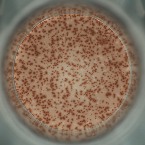 Human IFN-γ(HRP)OneStep ELISpot Kit