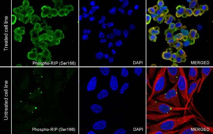 Phospho-RIP (Ser166) Recombinant Rabbit mAb (S-2702-58)
