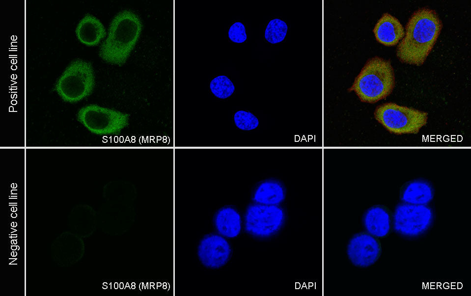 S100A8 (MRP8) Recombinant Rabbit mAb (SDT-059-28)