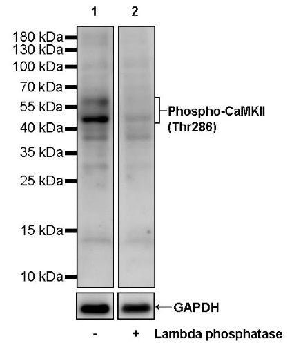 Phospho-CaMKII (Thr286) Recombinant Rabbit mAb (S-1251-278)