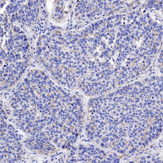 ZO-1 Recombinant Rabbit mAb