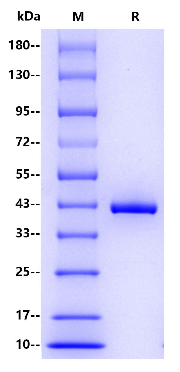 CHI3L1 His Tag Protein, Human