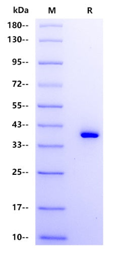 Human CCL22 Protein, hFc tag