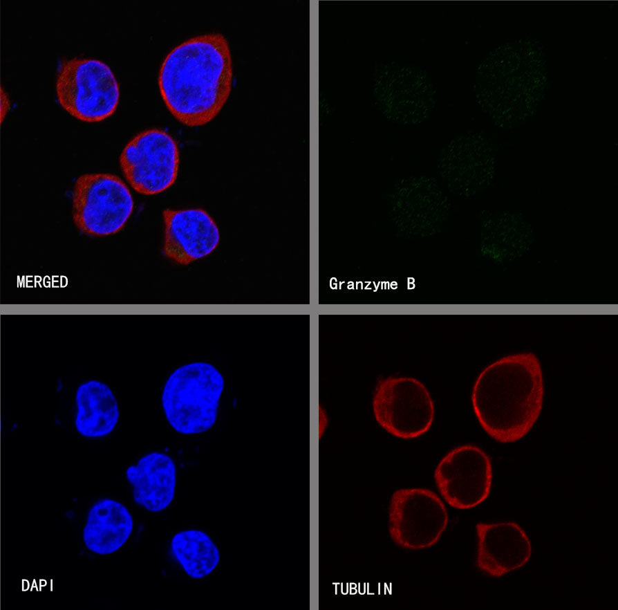 Granzyme B Recombinant Rabbit mAb (S-357-54)