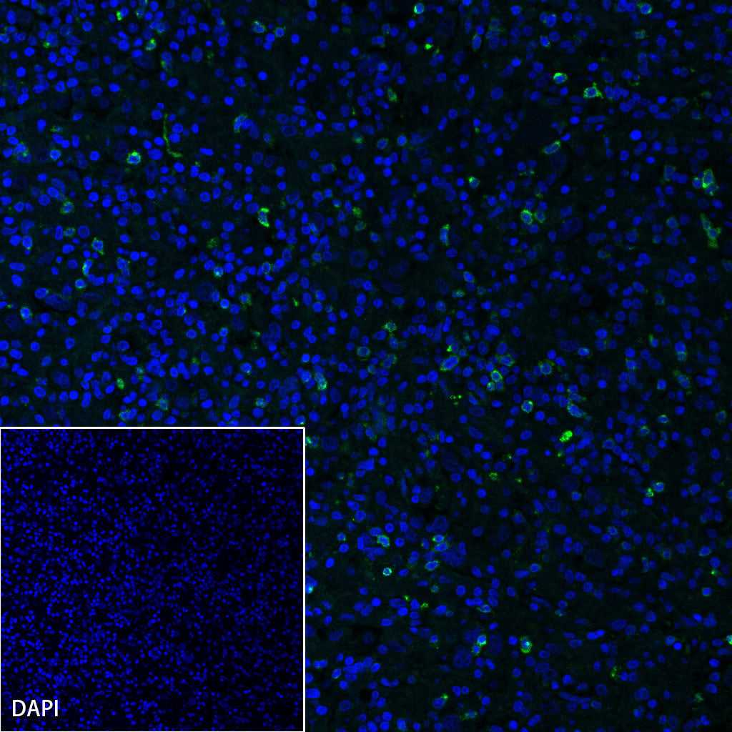 LAG3 Recombinant Rabbit mAb (SDT-R159)