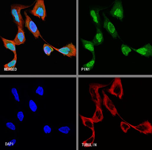 PIN1 Recombinant Rabbit mAb (S-2731-43)