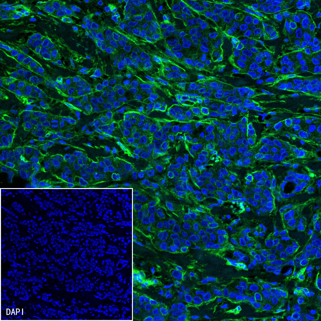 S-RMab®B7-H3/CD276 Recombinant Rabbit mAb (SDT-R158)
