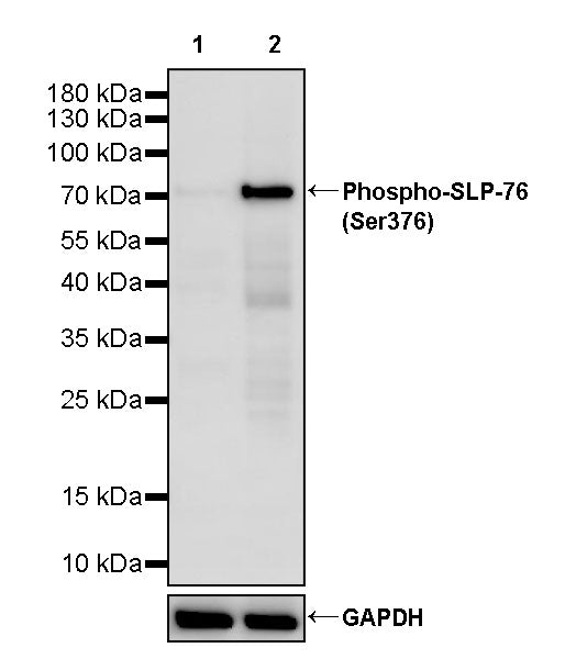 Phospho-SLP-76 (Ser376) Recombinant Rabbit mAb (S-3106-47)