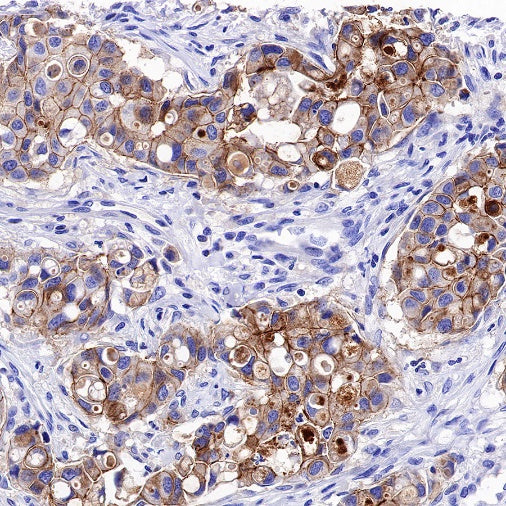 Nectin-4 Recombinant Rabbit mAb (SDT-277-326)