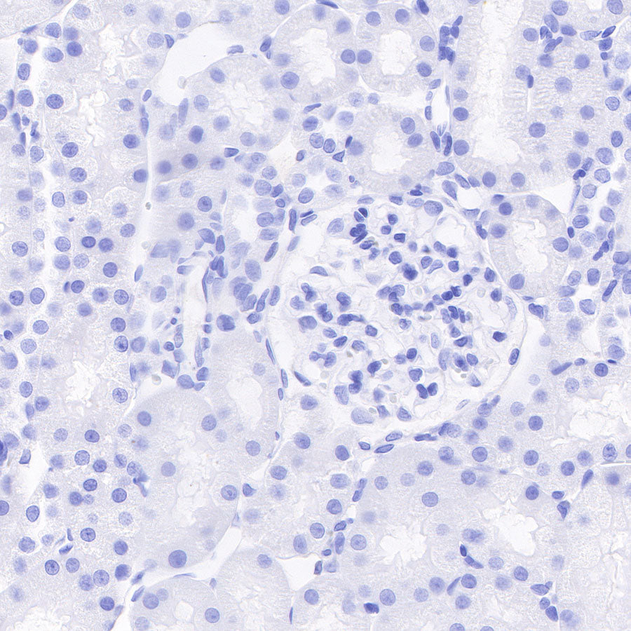 CAIX Recombinant Rabbit mAb (SDT-356-21)
