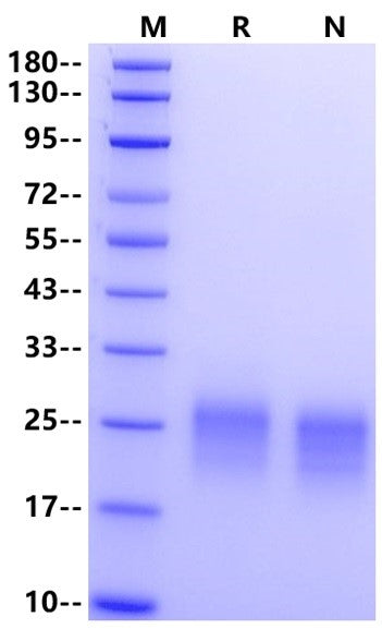 Frizzled-4/FZD4 His Tag Protein, Human