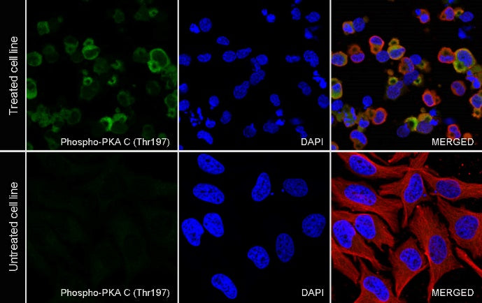 Phospho-PKA C (Thr197) Recombinant Rabbit mAb (S-1137-310)