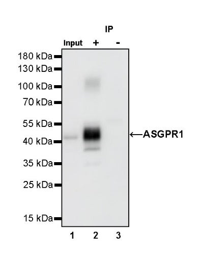 ASGPR1 Recombinant Rabbit mAb (S-R292)