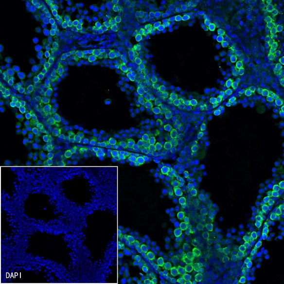 DAZL Rabbit Polyclonal Antibody