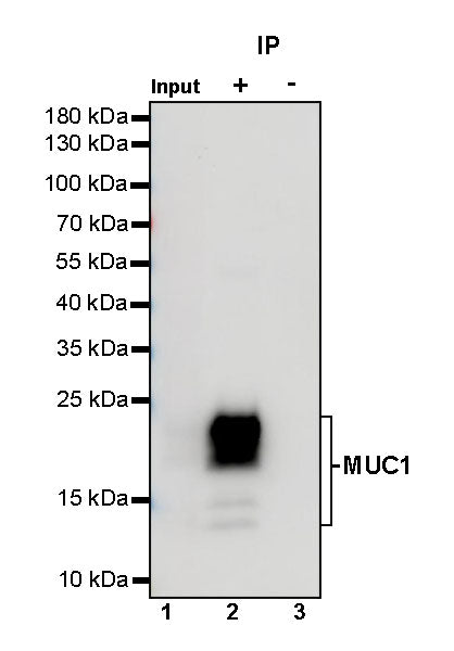 MUC1 Mouse mAb (SDT-777-71)