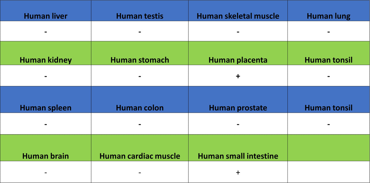 NOD2 Recombinant Rabbit mAb (SDT-3245-112)