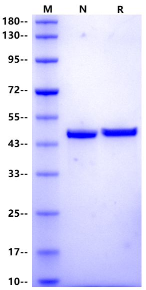 Cardiac Troponins T (cTnT) His Tag, Human