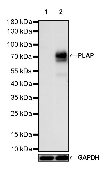 PLAP+ALPI Recombinant Rabbit mAb (SDT-167-155)