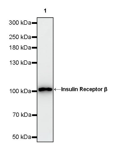 Insulin Receptor β Recombinant Rabbit mAb (S-2605-10)