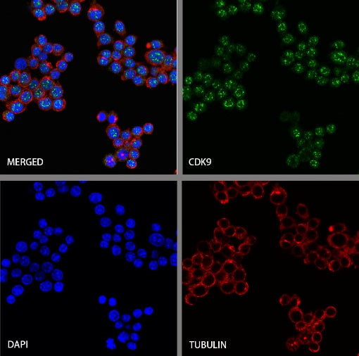CDK9 Recombinant Rabbit mAb (S-2661-10)