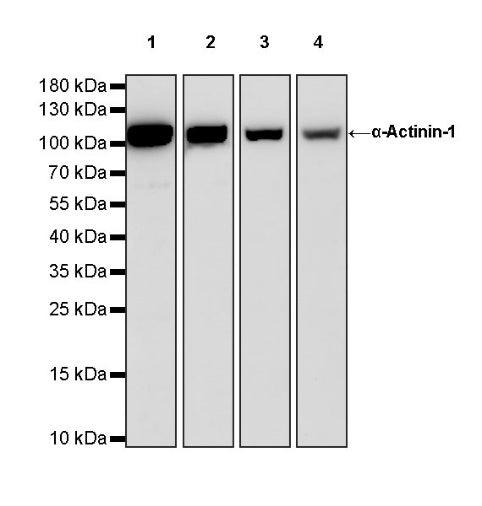 α-Actinin-1 Recombinant Rabbit mAb (HRP Conjugate) (SDT-311-20)