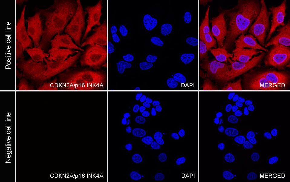 CDKN2A/p16 INK4A Recombinant Mouse mAb (Alexa Fluor® 594 Conjugate) (SDT-4675)