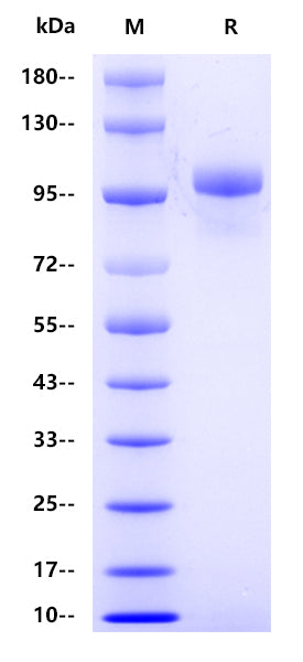 Human Thyroid peroxidase, His tag