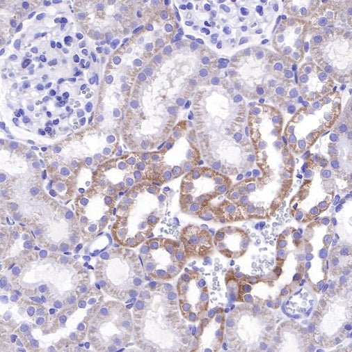 Bcl-xL Recombinant Rabbit mAb (S-487-28)