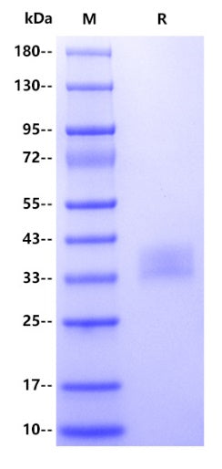 Human SFTPA2 Protein, His Tag