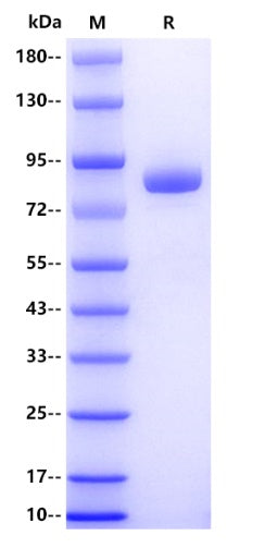 Human DSC2/Desmocollin-2 Protein, His tag