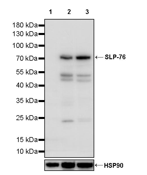 SLP-76 Recombinant Rabbit mAb (S-3472-13)