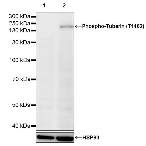 Phospho-Tuberin (T1462) Recombinant Rabbit mAb (S-987-126)