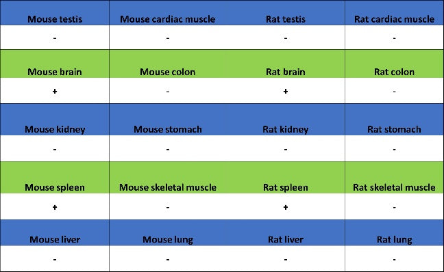 Ctip2 Recombinant Rabbit mAb (S-1375-21)