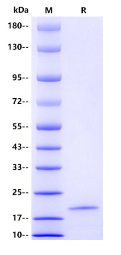 Human FoxO1 Protein, His tag