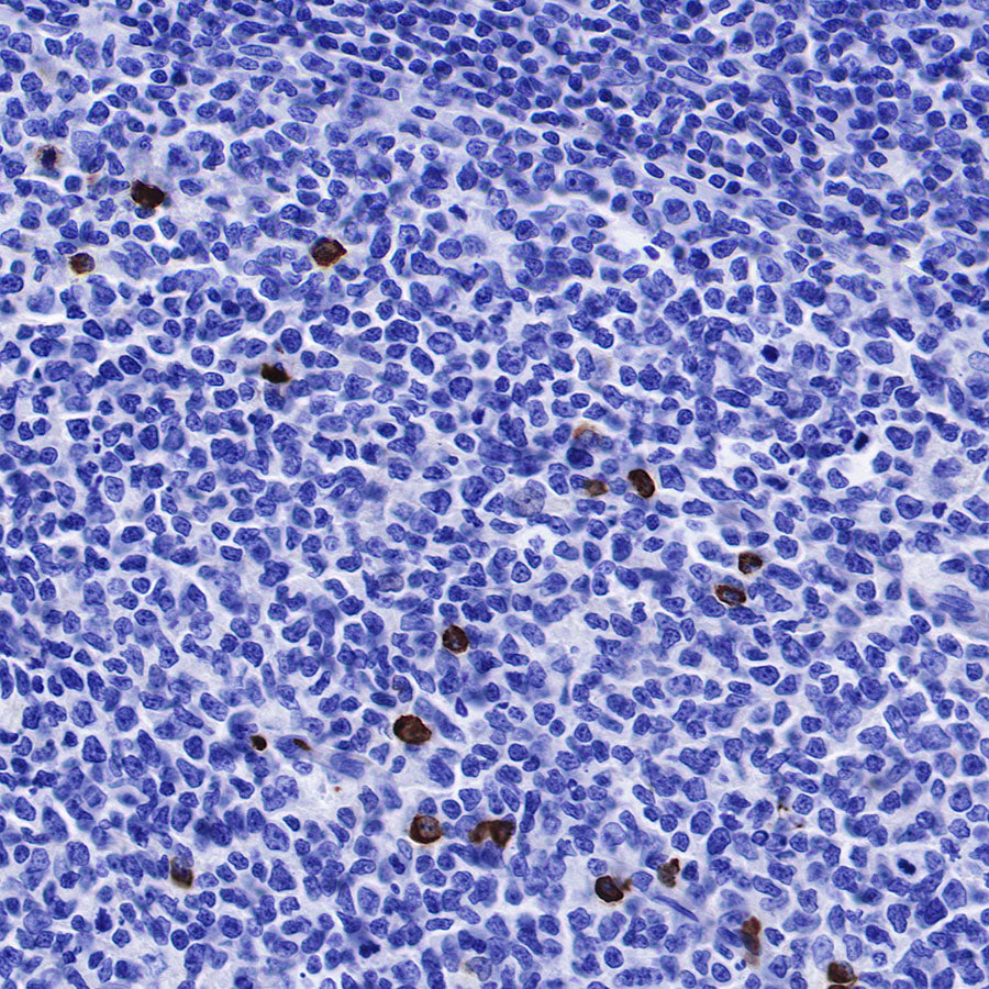 Human IgG3 F(c) Recombinant Rabbit mAb (SDT-318-77)