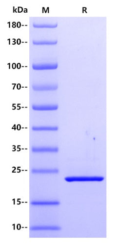 Human DHFR Protein, His tag