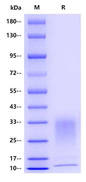 Human IL-13 Protein, His Tag