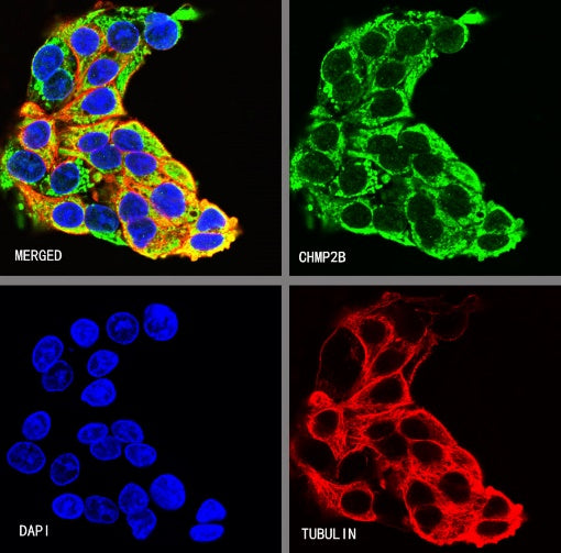 CHMP2B Recombinant Rabbit mAb (S-1639-20)