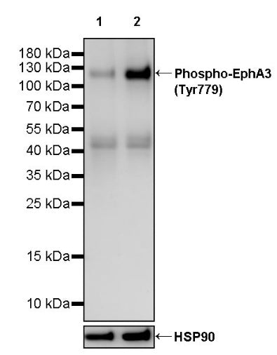 Phospho-EphA3 (Tyr779) Recombinant Rabbit mAb (S-3551)