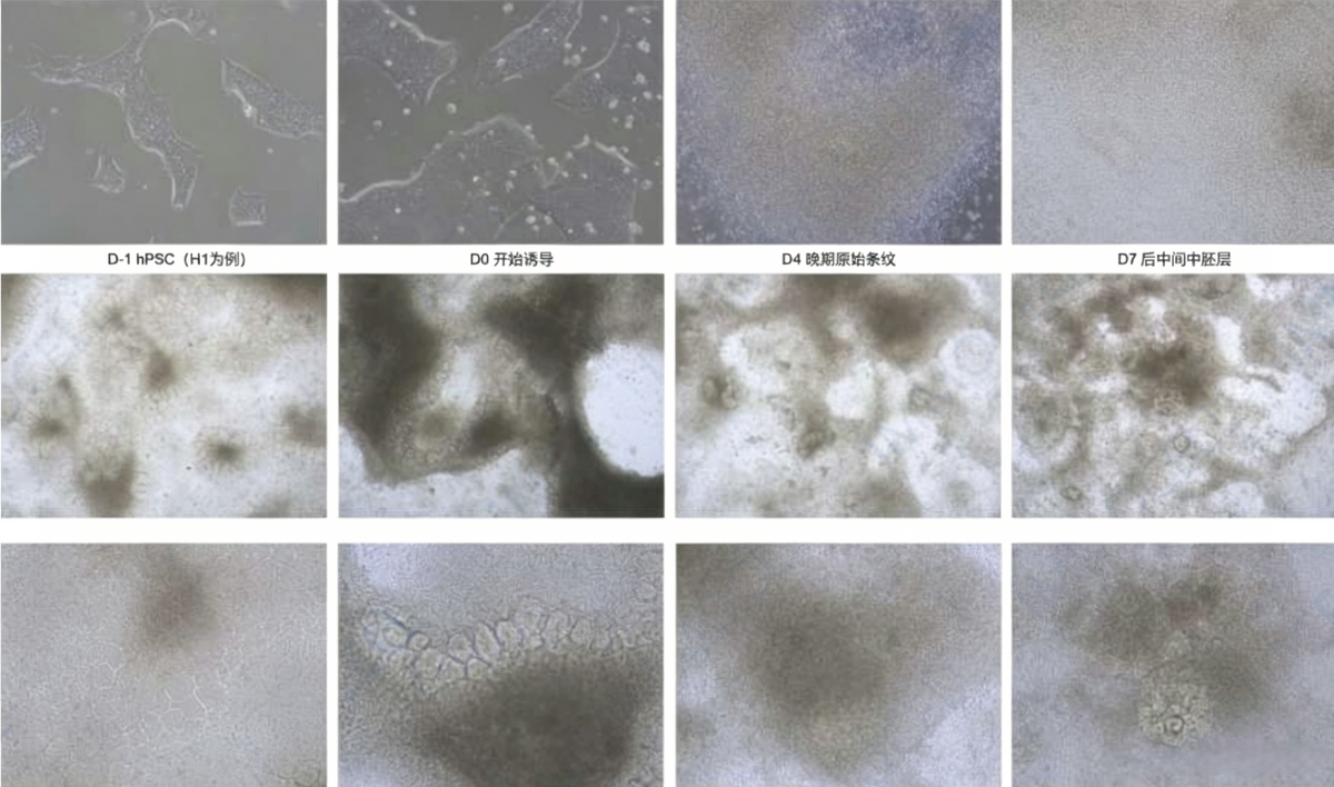 hPSC Inducing Differentiation of Renal Organoids Kit