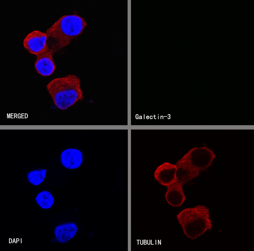 Galectin-3 Recombinant Rabbit mAb (SDT-370-111)