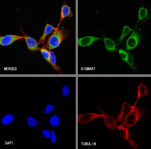 SIGMAR1 Recombinant Rabbit mAb (S-2079-270)