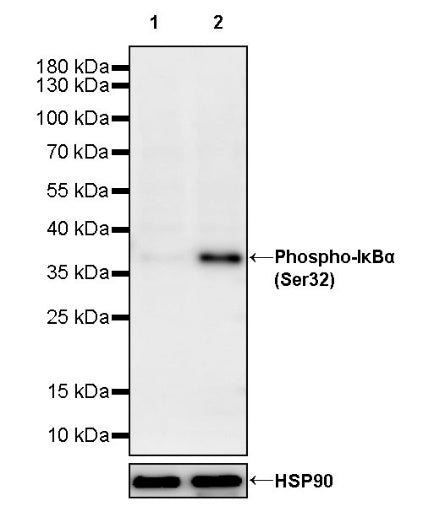 Phospho-IκBα (Ser32) Recombinant Rabbit mAb (S-1084-395)