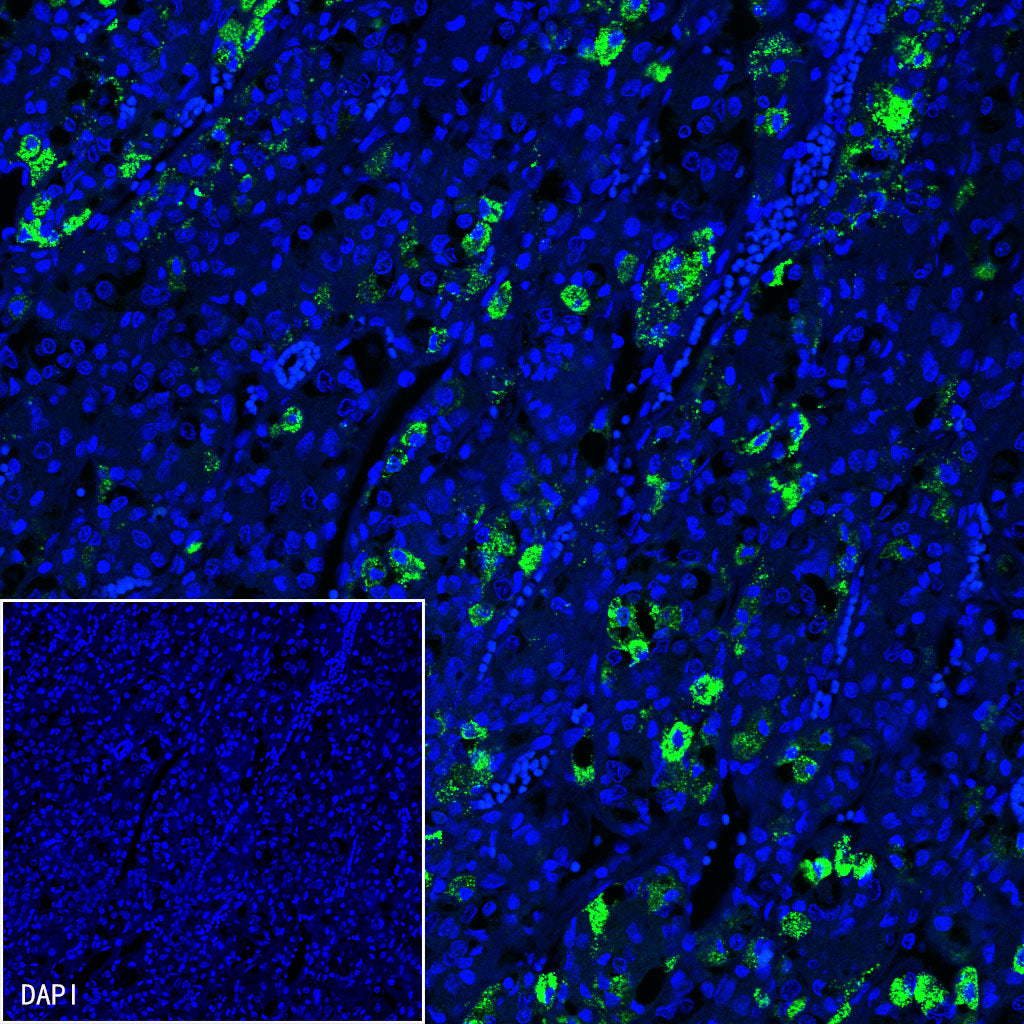 FSHB Recombinant Rabbit mAb (SDT-R287)
